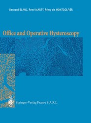 Office and Operative Hysteroscopy