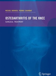 Osteoarthritis of the knee