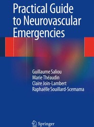 Practical Guide to Neurovascular Emergencies