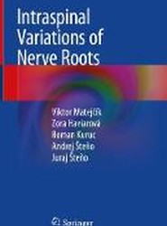 Intraspinal Variations of Nerve Roots