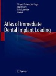 Atlas of Immediate Dental Implant Loading