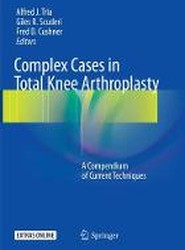 Complex Cases in Total Knee Arthroplasty