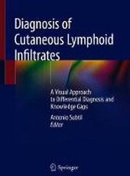 Diagnosis of Cutaneous Lymphoid Infiltrates