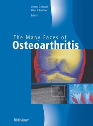 The Many Faces of Osteoarthritis