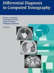 Differential Diagnosis in Computed Tomography