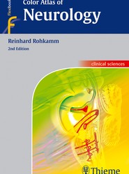 Color Atlas of Neurology