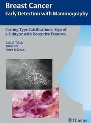 Casting-Type Calcifications: Sign of a Subtype with Deceptive Features