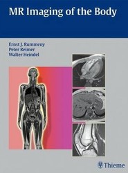 MR Imaging of the Body
