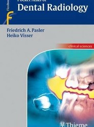 Pocket Atlas of Dental Radiology