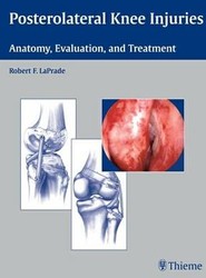 Posterolateral Knee Injuries