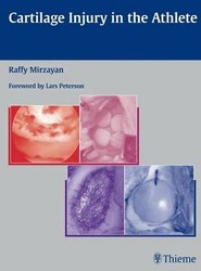 Cartilage Injury in the Athlete