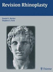 Revision Rhinoplasty