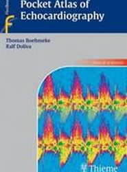 Pocket Atlas of Echocardiography
