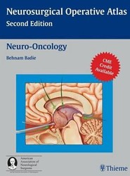 Neuro-oncology