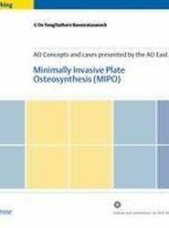 Minimally Invasive Plate Ostheosynthesis (MIPO)