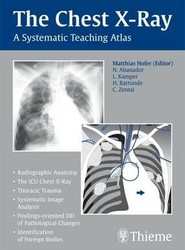 The Chest X-Ray