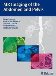 MR Imaging of the Abdomen and Pelvis