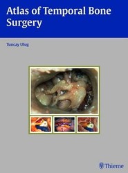 Atlas of Temporal Bone Surgery