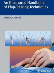 An Illustrated Handbook of Flap-Raising Techniques