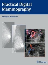 Practical Digital Mammography