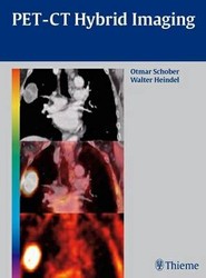PET-CT Hybrid Imaging