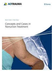 Concepts and Cases in Nonunion Treatment