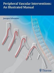 Peripheral Vascular Interventions: An Illustrated Manual