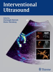 Interventional Ultrasound