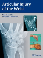 Articular Injury of the Wrist