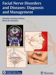 Facial Nerve Disorders and Diseases: Diagnosis and Management