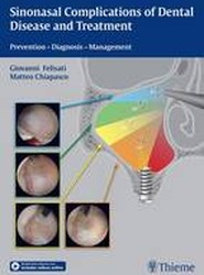 Sinonasal Complications of Dental Disease and Treatment