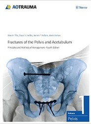 Fractures of the Pelvis and Acetabulum (AO)