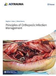 Principles of Orthopedic Infection Management