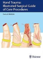 Hand Trauma: Illustrated Surgical Guide of Core Procedures
