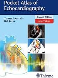 Pocket Atlas of Echocardiography
