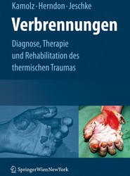 Verbrennungen
