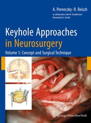 Key Hole Approaches in Neurosurgery: Concept and Surgical Technique Volume 1