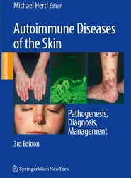 Autoimmune Diseases of the Skin