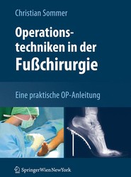 Operationstechniken in der Fusschirurgie