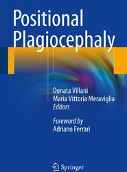 Positional Plagiocephaly