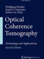 Optical Coherence Tomography