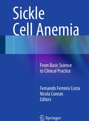 Sickle Cell Anemia