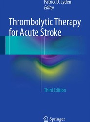 Thrombolytic Therapy for Acute Stroke