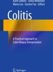 Colitis