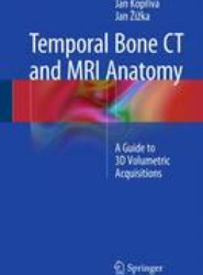 Temporal Bone CT and MRI Anatomy