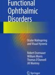 Functional Ophthalmic Disorders