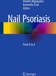 Nail Psoriasis