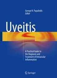 Uveitis