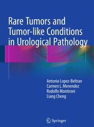 Rare Tumors and Tumor-like Conditions in Urological Pathology