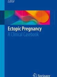 Ectopic Pregnancy